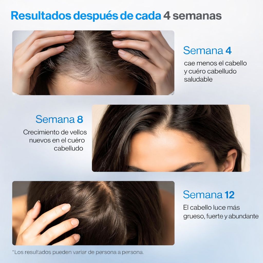 Serum Roll-On Anticaída