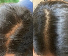 Serum Roll-On Anticaída